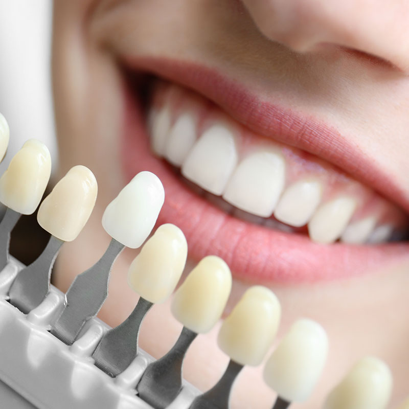 True Vine Dental Care | Dentures, Dental Cleanings and Night Guards